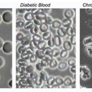 Live Blood Cell Analysis